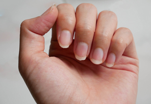 照腸鏡費用知多少？瞭解檢查的必要性和價格