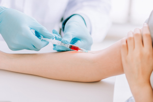 結腸內視鏡檢查：及早發現腸道問題的關鍵